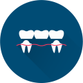 Dentures